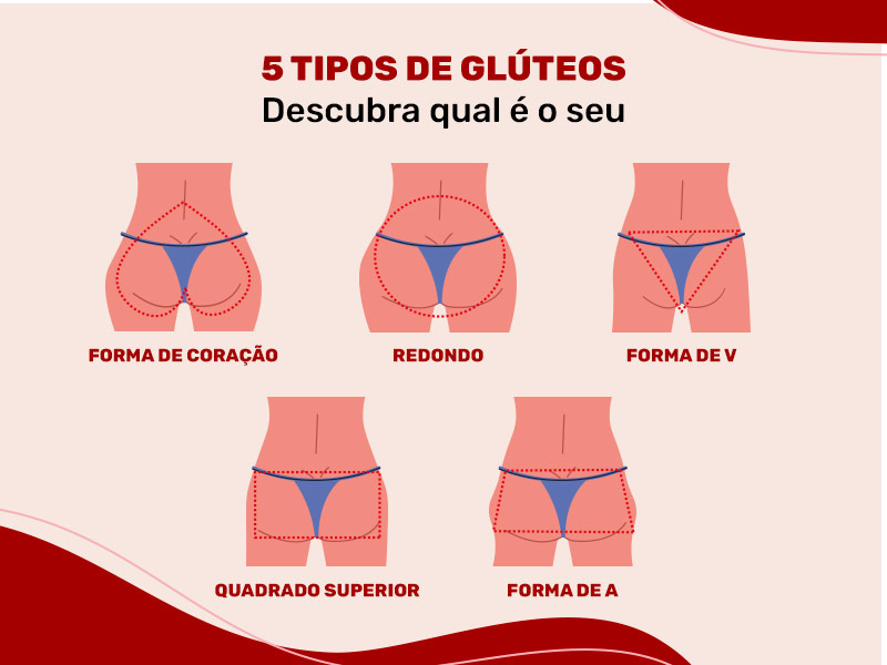 Ilustração mostrando os 5 tipos de glúteos, que são em formato de quadrado superior, em forma de V, redondo e forma de coração.