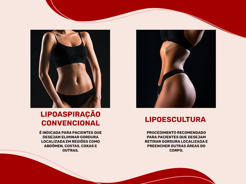 Ilustração mostrando as diferenças entre a lipoaspiração e lipoescultura