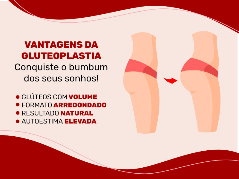 Ilustração mostrando o resultado da cirurgia para aumentar o bumbum com os seguintes dizeres: Vantagens da Gluteoplastia. Conquiste o bumbum dos seus sonhos! Glúteos com volume, formato arredondado, resultado natural e autoestima elevada