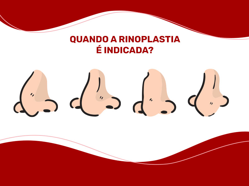 Ilustração com 4 tipos diferentes de nariz