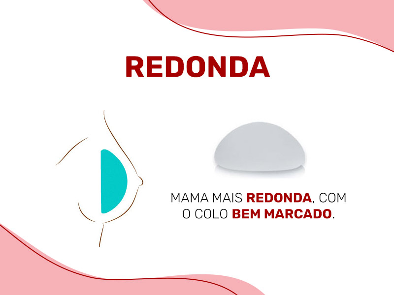 Ilustração mostrando a prótese de silicone redondo dentro do seio