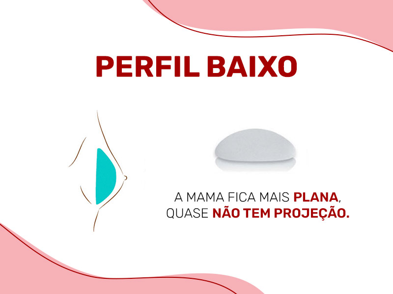 Ilustração mostrando a prótese de silicone perfil baixo dentro do seio