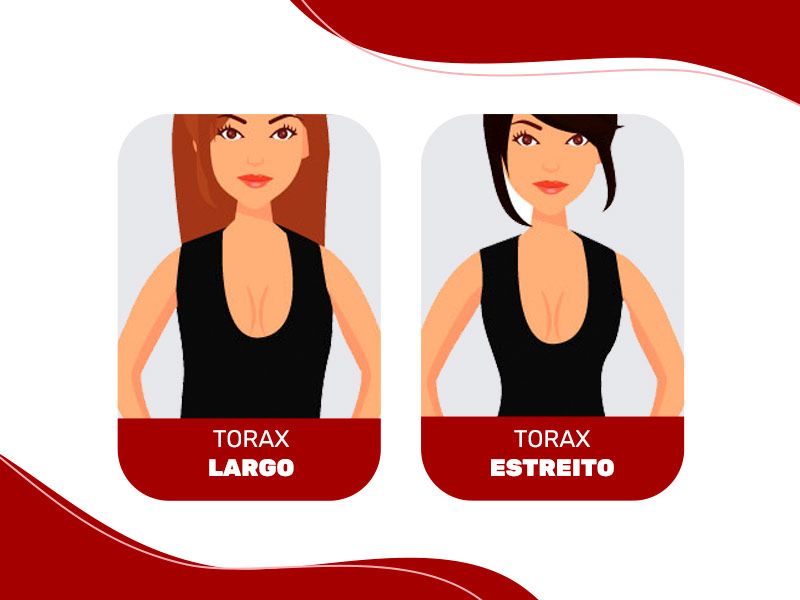 Ilustração de mulheres com tórax largo e estreito e os tipos de silicone para cada um deles