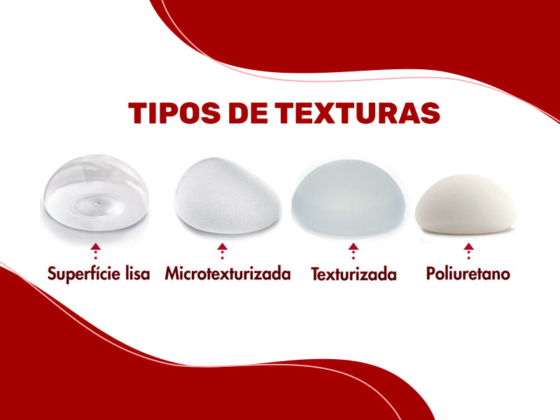 Ilustração mostrando os tipos de revestimentos para prótese de silicone