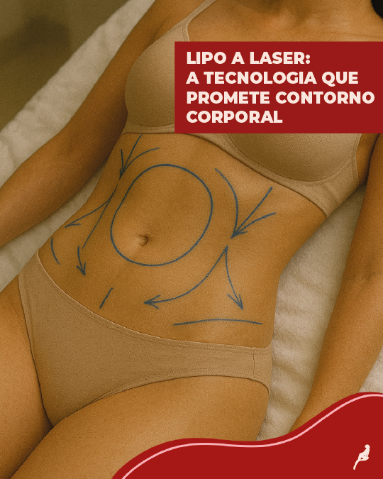 Ilustração com áreas tratadas por lipo a laser, destacando o contorno corporal com tecnologia não invasiva