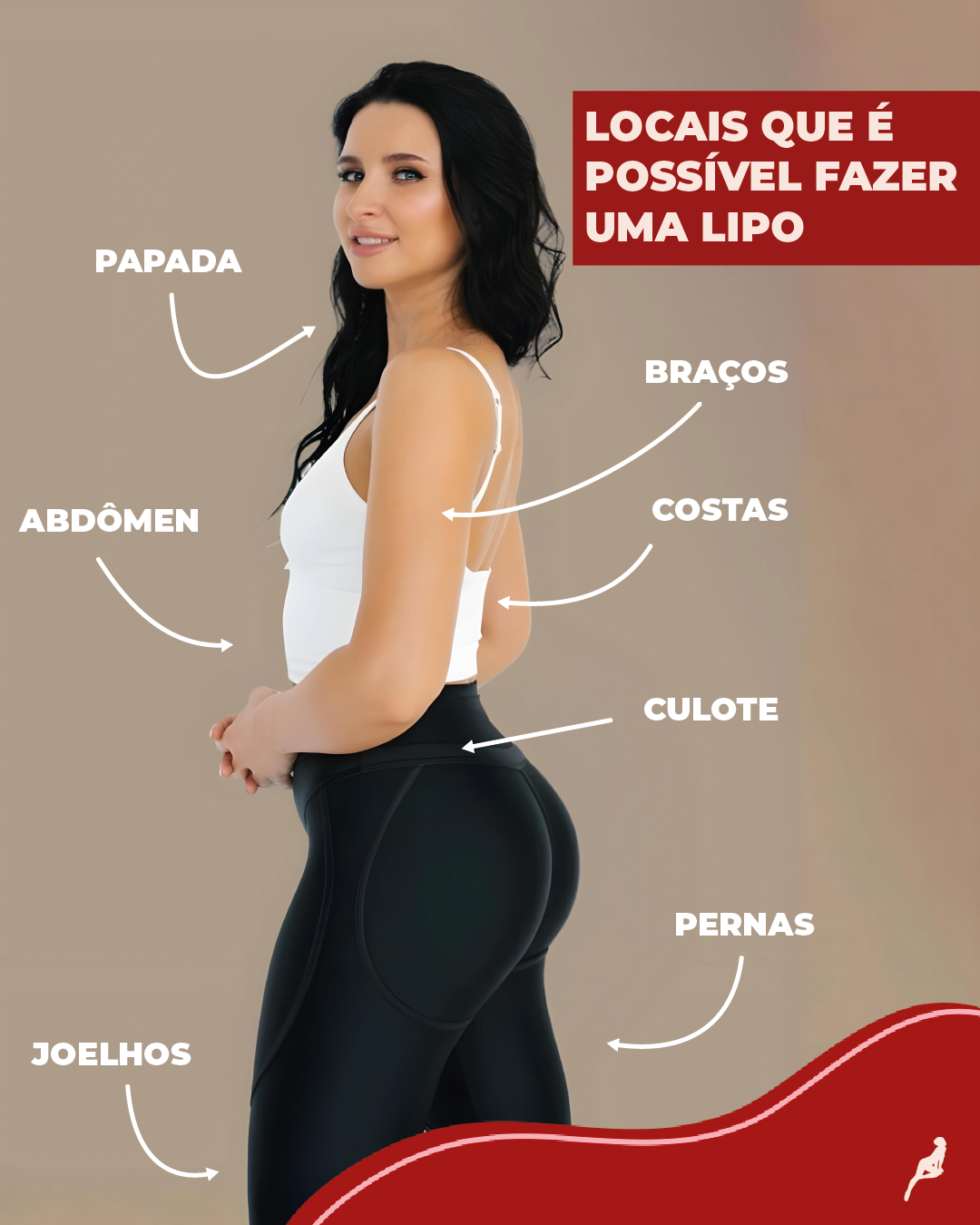 Mulher com marcações nas principais regiões onde a lipoaspiração pode ser realizada