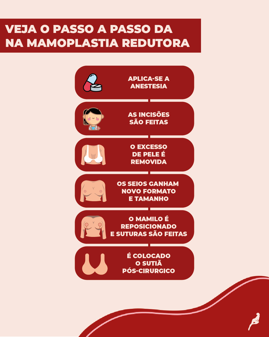 Como é feita a cirurgia da mamoplastia redutora? Passo a passo de como é feita a mamoplastia redutora