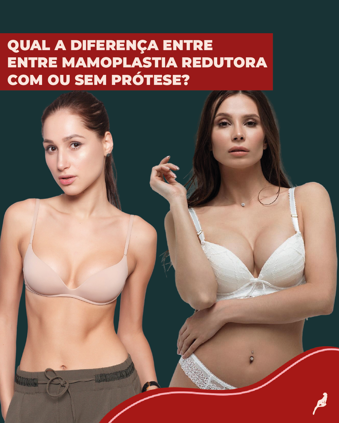 Mamoplastia redutora com ou sem prótese: qual a diferença? Duas mulheres, uma com seios pequenos e uma com seios grandes