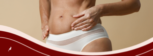 barriga operada mini abdominoplastia