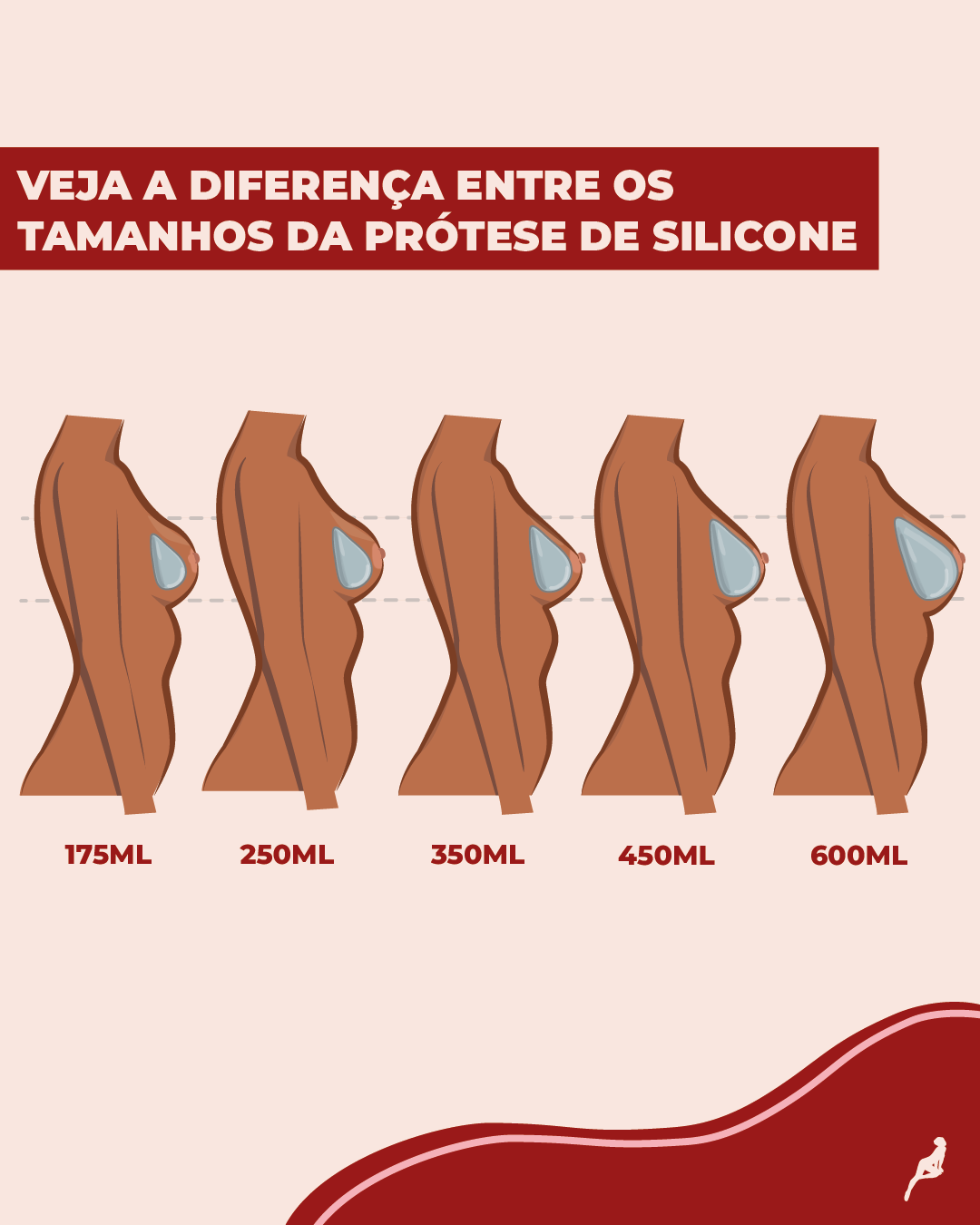 Quais são os tamanhos de prótese de silicone disponíveis? Ilustração que mostra como fica o resultado de perfil de próteses de silicone de tamanhos diferentes