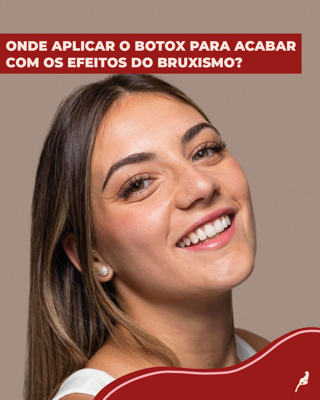 pontos de aplicação do botox para bruxismo