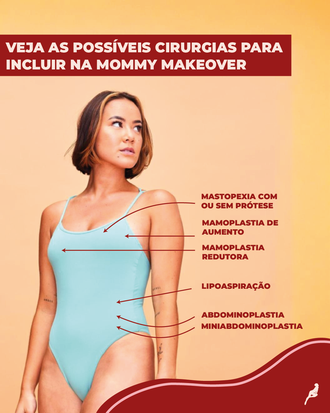 cirurgias incluídas no mommy makeover