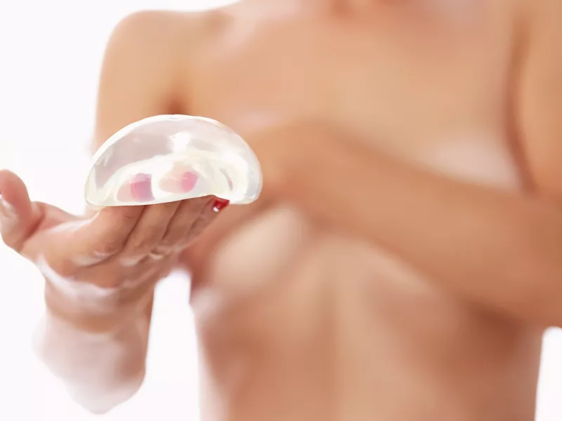 Como eliminar a assimetria mamária com Prótese de Silicone? assimetria mamaria apos implante silicone