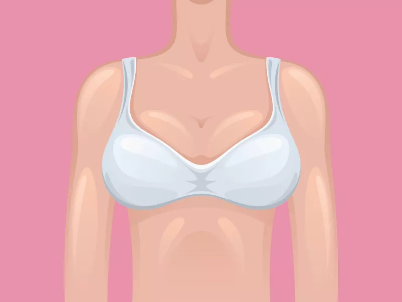 O que é simastia na prótese de silicone? Outro tipo de deslocamento? simastia protese silicone