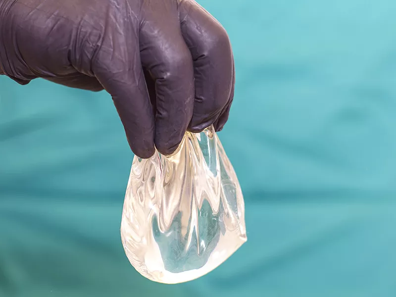 Rompimento da Prótese de mama ruptura protese silicone