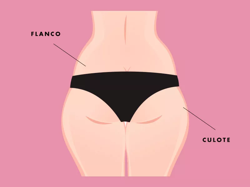 Lipoaspiração de flancos e culote flancos e culote