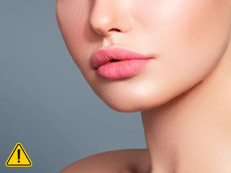 O que fazer no caso em que o preenchimento labial deu errado