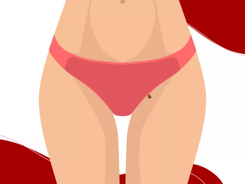 Imagem ilustrativa de verruga na virilha