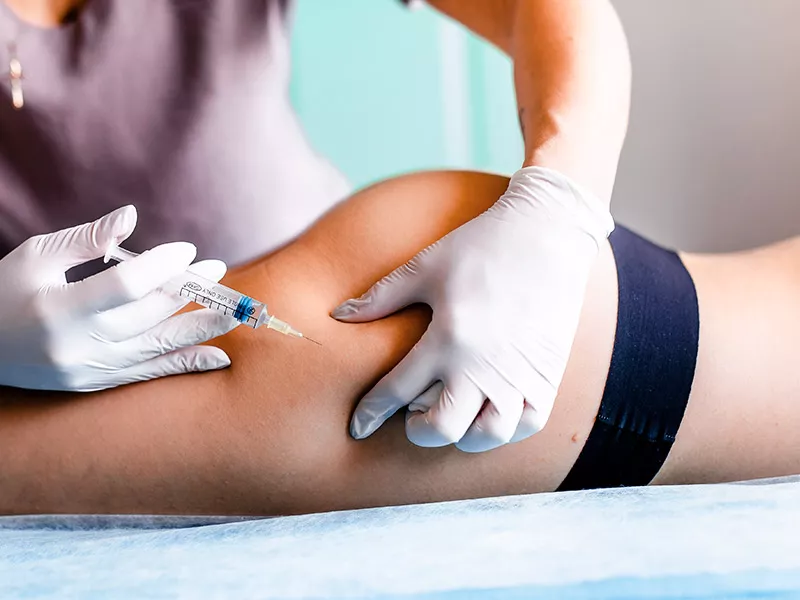 O TRATAMENTO PARA ESTRIAS COM ÁCIDO HIALURÔNICO FUNCIONA? mulher aplicando ácido hialurônico no bumbum para eliminar as estrias