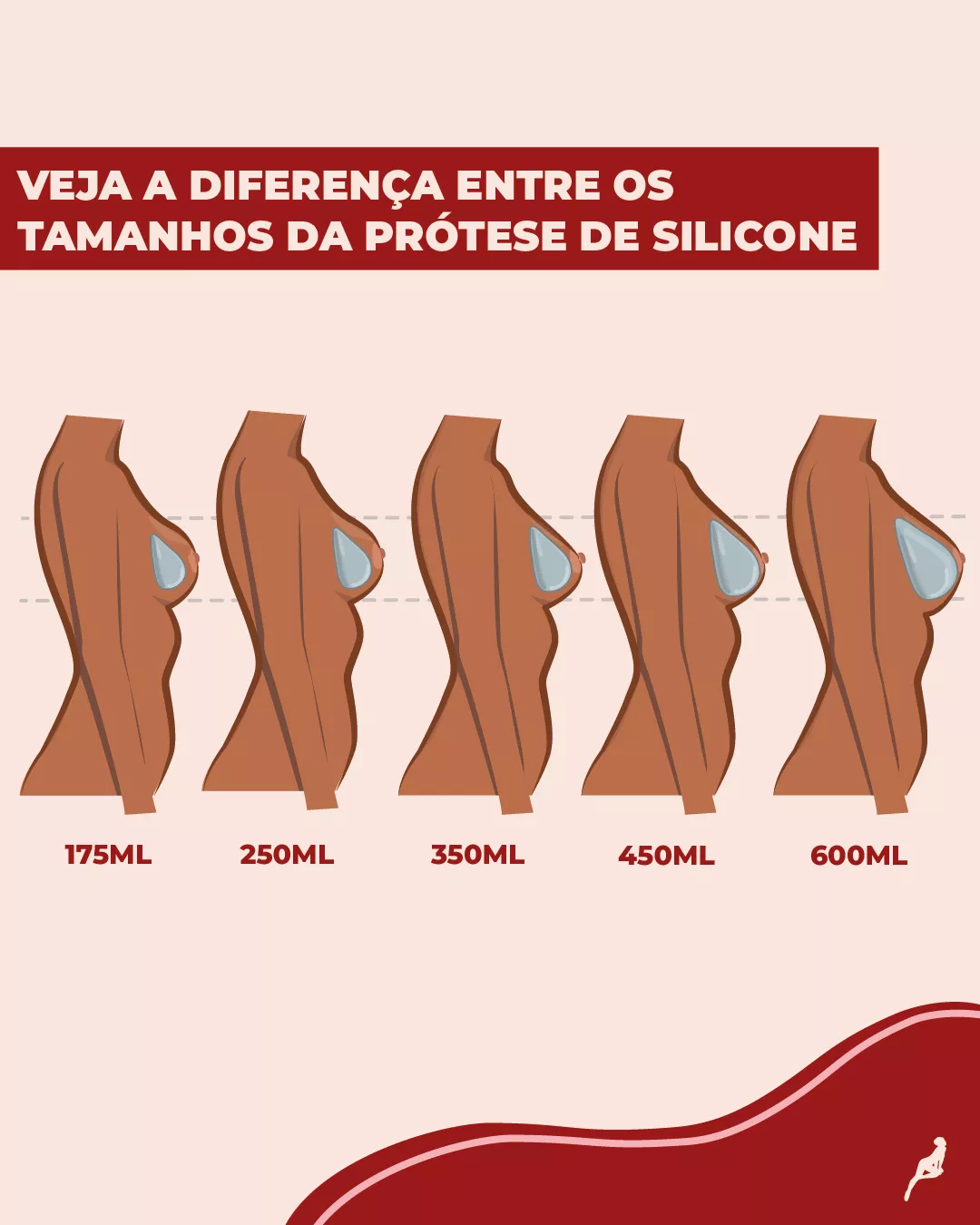 Quais são os tamanhos de prótese de silicone disponíveis? Ilustração que mostra como fica o resultado de perfil de próteses de silicone de tamanhos diferentes